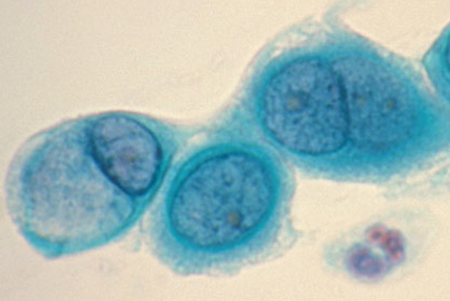 <p>clamidia</p>