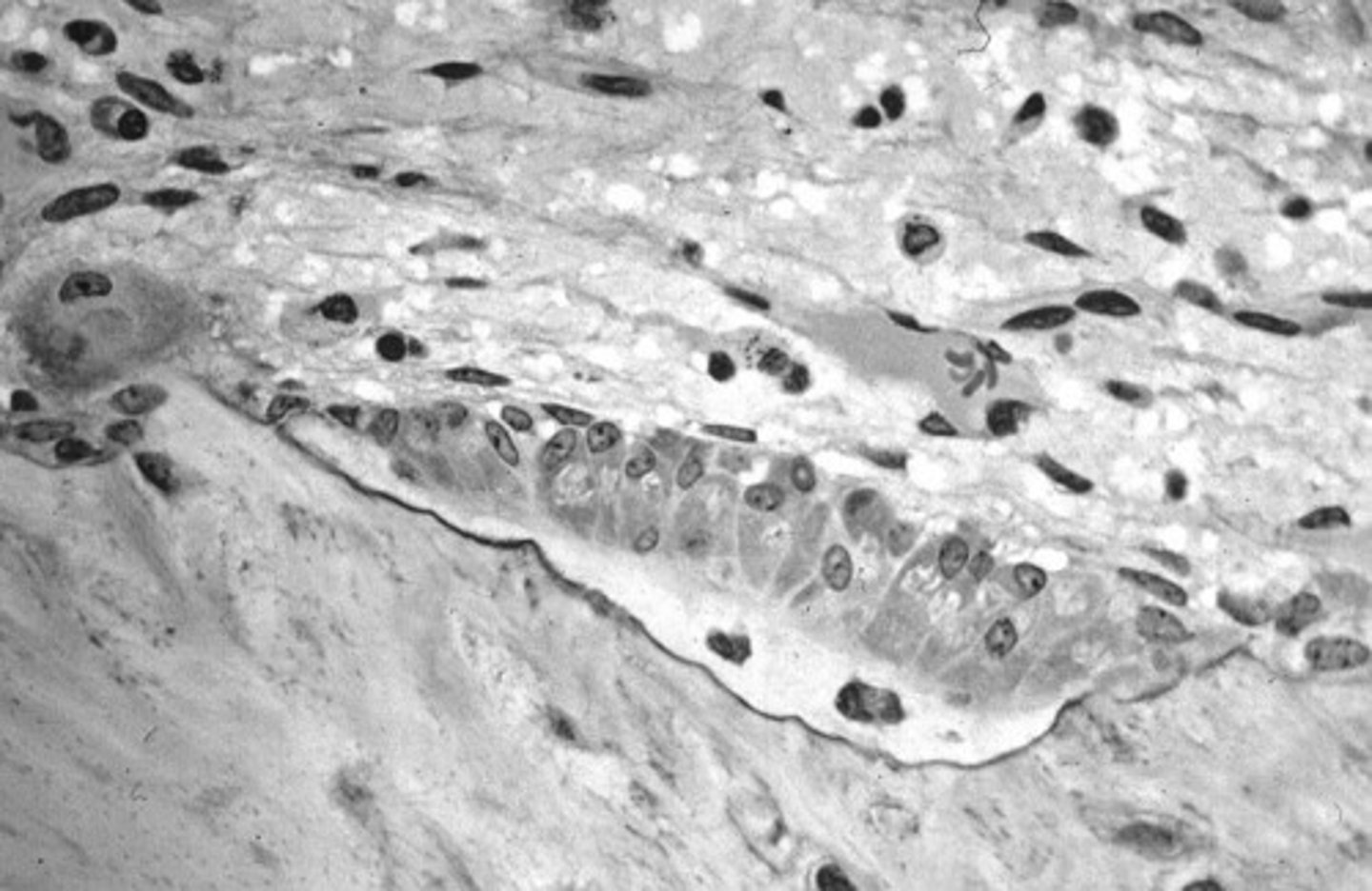 <p>osteoid</p>