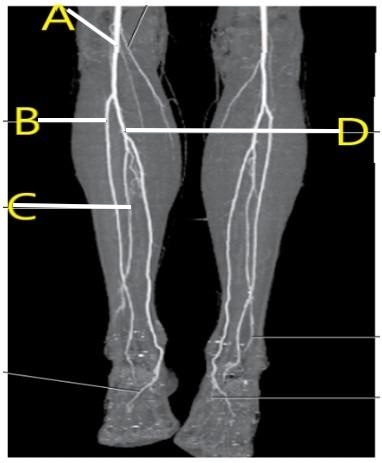 <p>Which letter is the popliteal artery?</p>