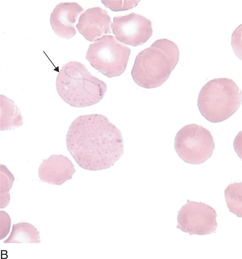 <p>what are cabot rings? (RBC inclusions)</p>