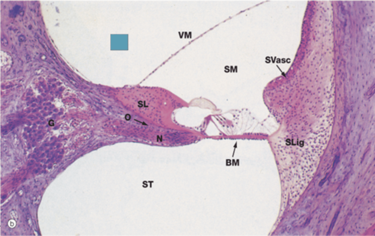 <p>Identify the structure (BLUE BOX)</p>