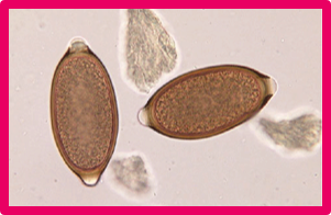 Ex. 
Trichuris vulpis