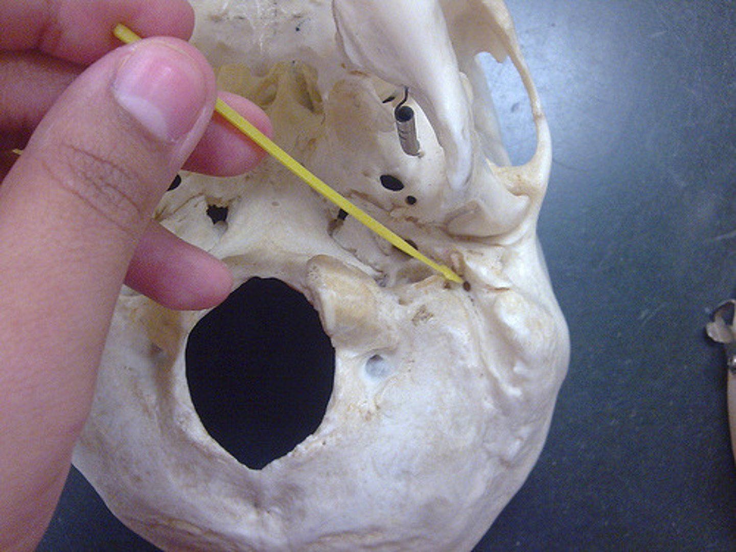 <p>located near the posterior edge of the mastoid process along the occipitomastoid suture</p>