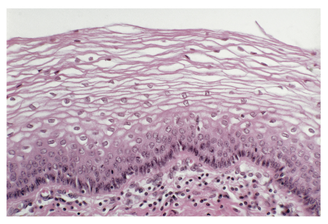 <p>Stratified squamous epithelium.</p>
