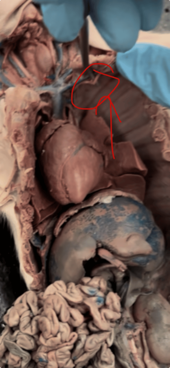 <p>interior chest wall + diaphragm</p>