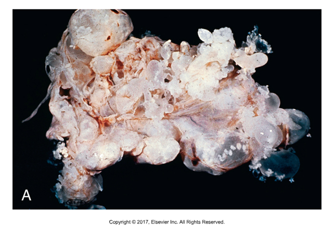 <p>“Many headed worm”</p><ul><li><p>Affects: Dogs, not zoonotic​</p></li><li><p>Adult in small intestine​</p></li><li><p>Intermediate host: Sheep (M. multiceps) or rabbit (M. serialis)​</p></li><li><p>40 to 100cm long​</p></li><li><p>Double row armed scolex, taeniid eggs</p></li></ul><p></p>