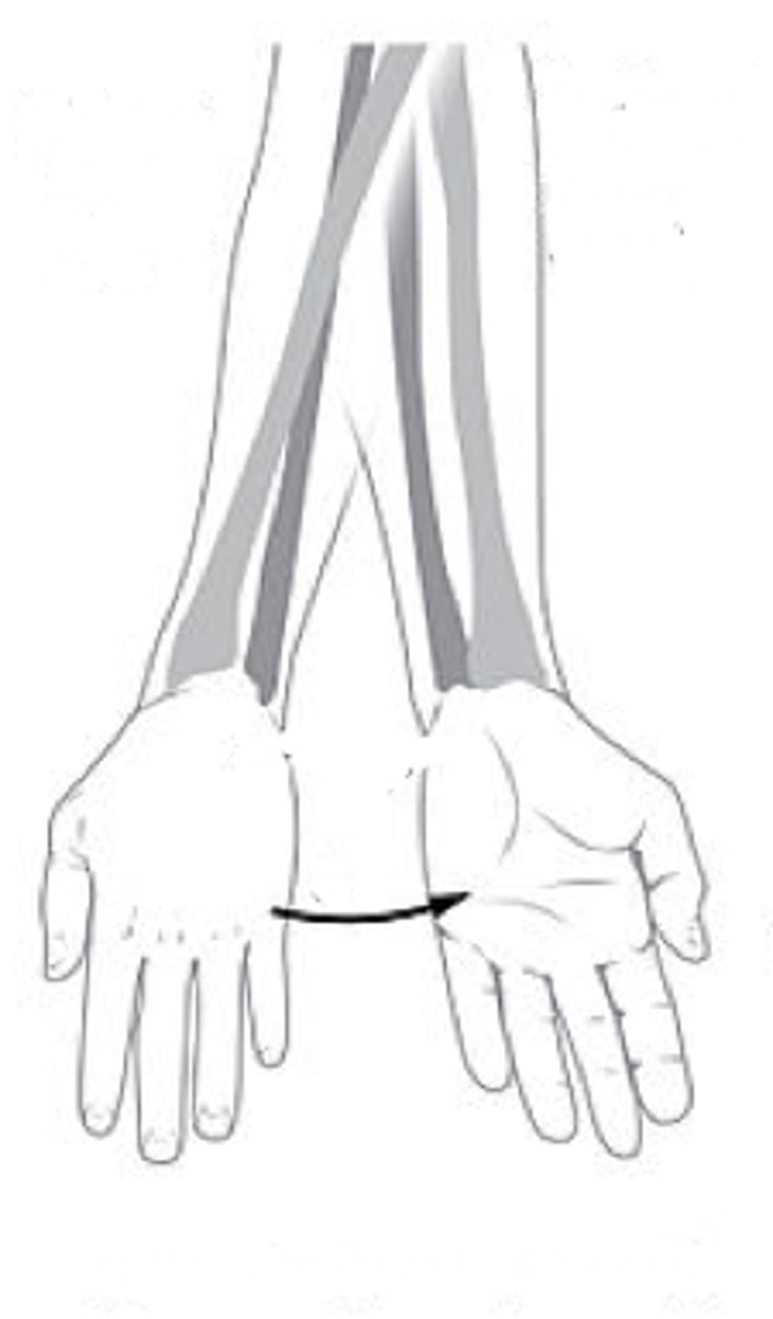 <p>Identify the action indicated in "A"</p>