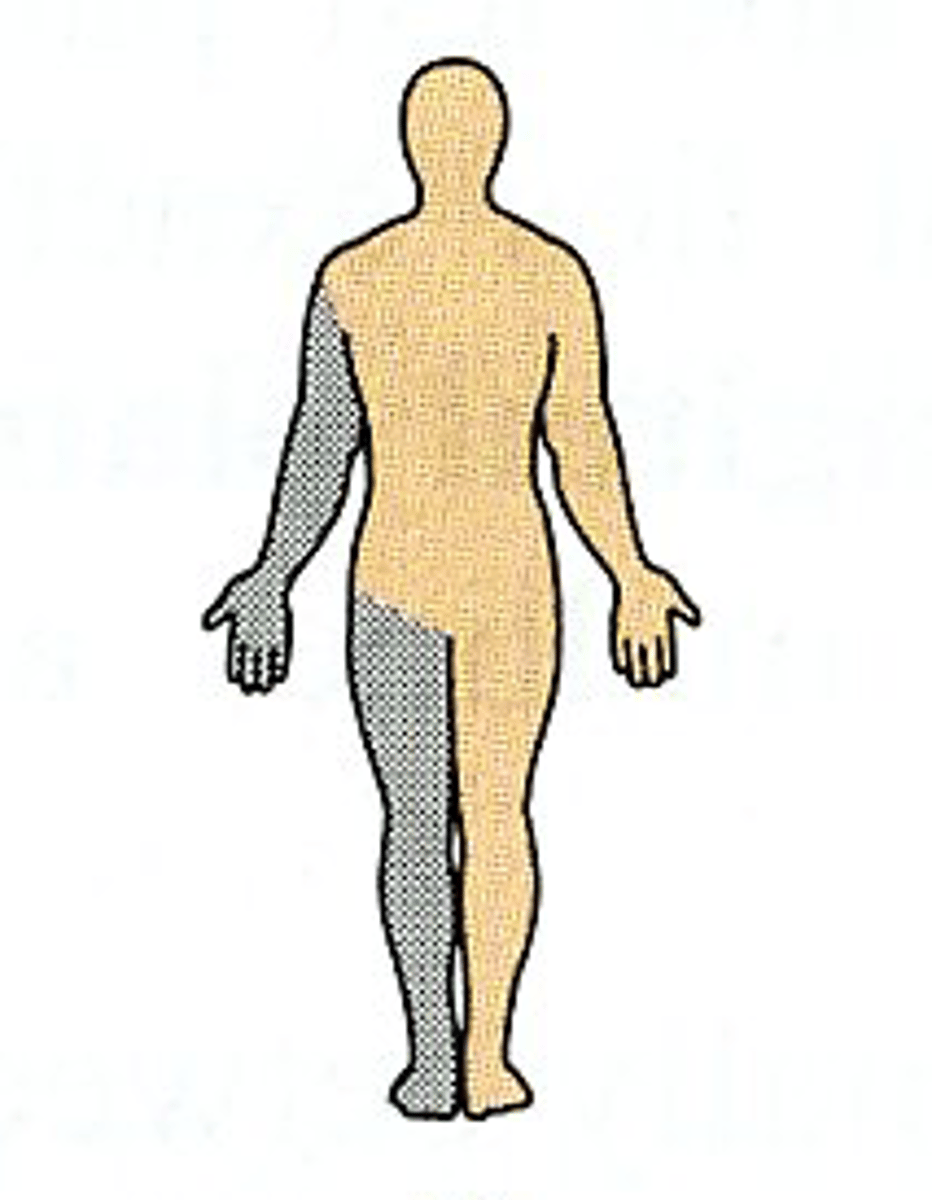 <p>on the same side of the body</p>
