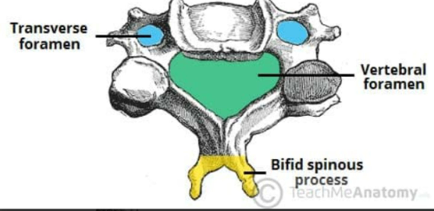 <p>• Laterally they have Foramen Transversarium for vessels to travel to skull</p><p>• Triangular Vertebral Canal</p><p>• C2 - C6 have Bipid Spinous Process</p>