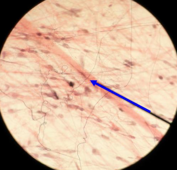 <p>What type of fiber is the arrow pointing to?</p>
