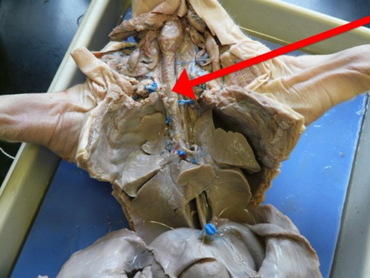 <p>Allows air to pass to and from lungs.</p><p>Air passageway; has cartilage rings to help keep the air passage open as air rushes in; branches into right/left bronchus. Between larynx and bronchi.</p>
