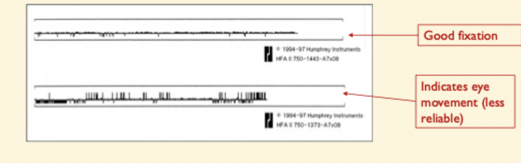 <ul><li><p>eye movements using purkinje images </p></li></ul><p></p><ul><li><p>upward detection = eye movements </p></li></ul><p></p><ul><li><p>downward deflection = loss of signal → blinking etc </p></li></ul><p></p><ul><li><p>relies on subjective assessment of whether you think fixation was good enough </p></li></ul><p></p>