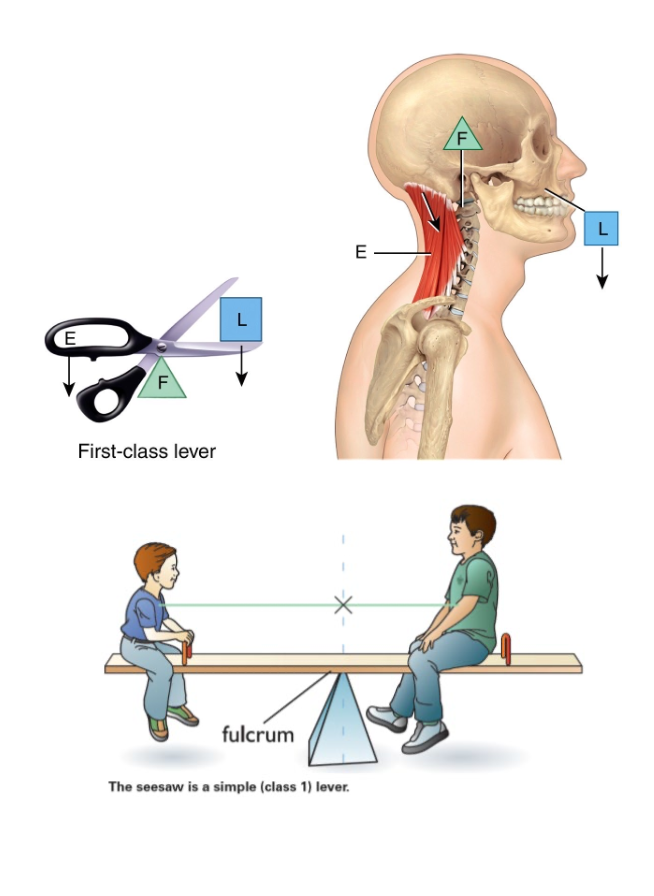 <p>Fulcrum (atlanto-occipital joint)</p><p>Load (facial bones)</p><p>Effort (muscles of the back of neck</p>