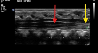 <ol><li><p>What structure is seen at the red arrow?</p></li><li><p>Yellow arrow?</p></li></ol><p></p>