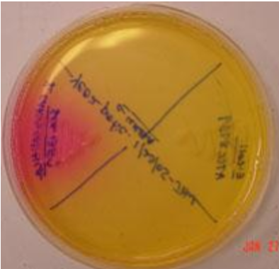 <p><span style="font-family: "Times New Roman";"><strong><span>Urease Test</span></strong></span></p>