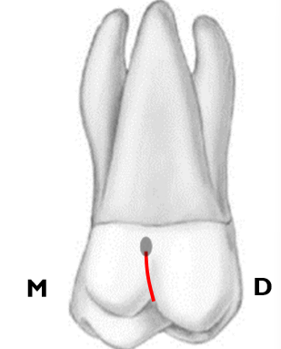 <p>begins: extension of the distal oblique groove</p><p>ends: in a fossa (sometimes a pit) near the center of the lingual surface</p>