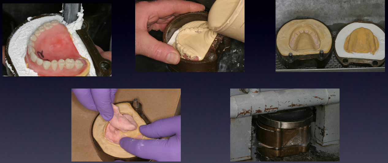 <p>Investing, boil-out, packing and curing</p>