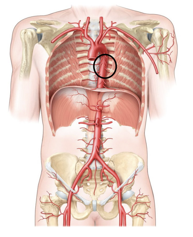 <p>The section of the descending aorta that supplies blood to the thoracic organs above the diaphragm.</p>