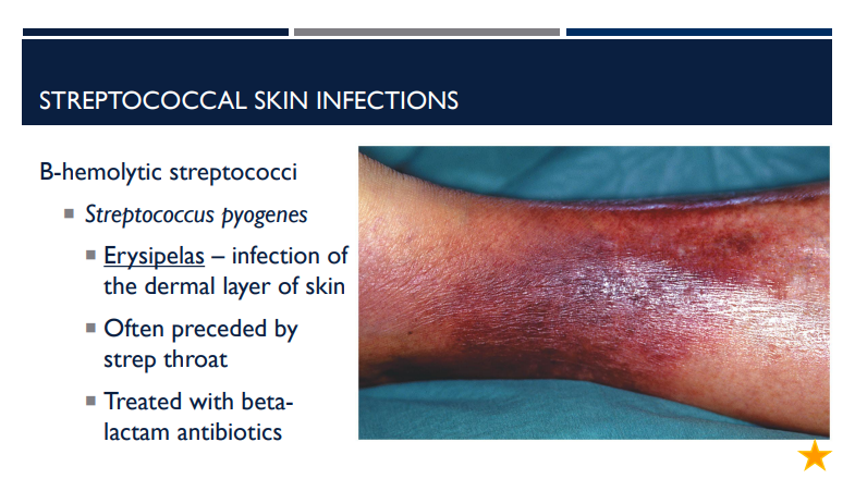 <p>What is erypsipelas, an infection of the dermal layer of the skin, often preceded by and treated with?</p>