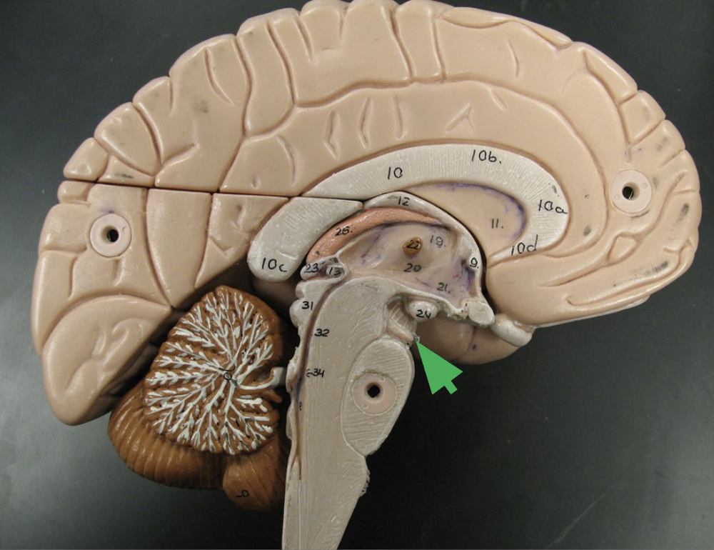term image