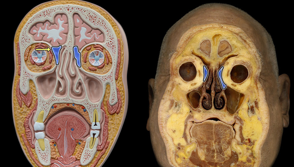 <p>Ethmoidal cells</p>