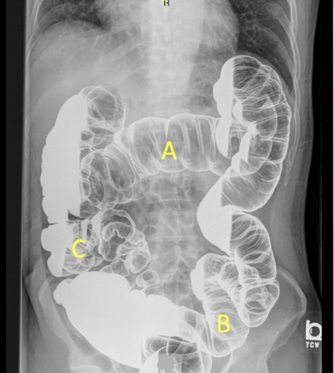 <p>Label the radiograph</p>