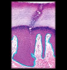 <p>What layer of the epidermis is highlighted</p>