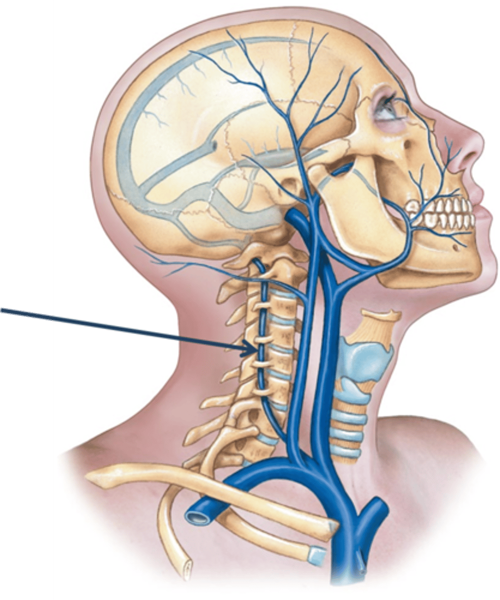 <p>Name this vessel.</p>