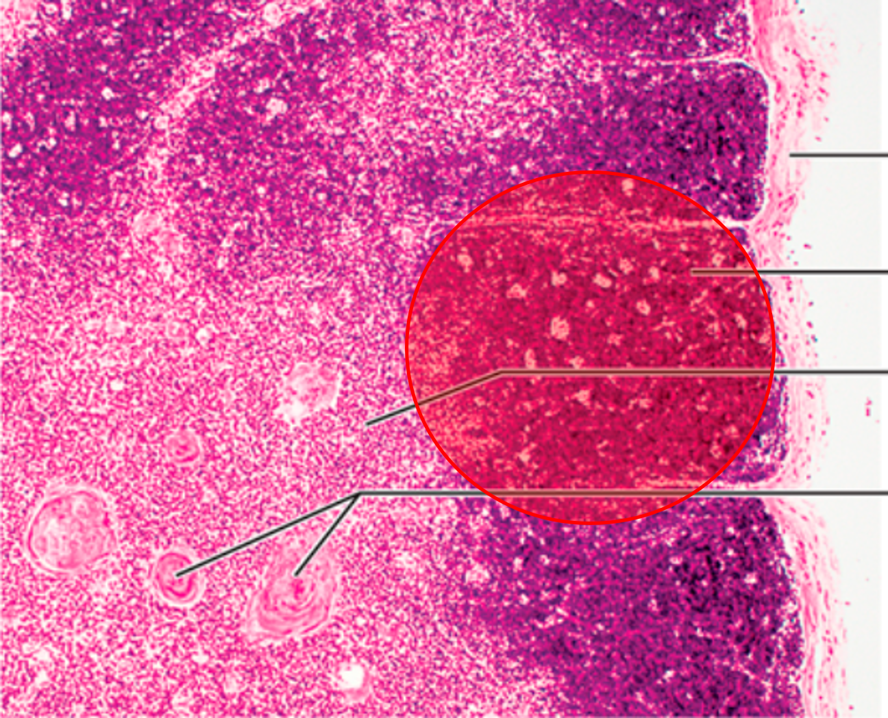 • Basic unit of the thymus.

• Contains an outer cortex and an inner medulla.
