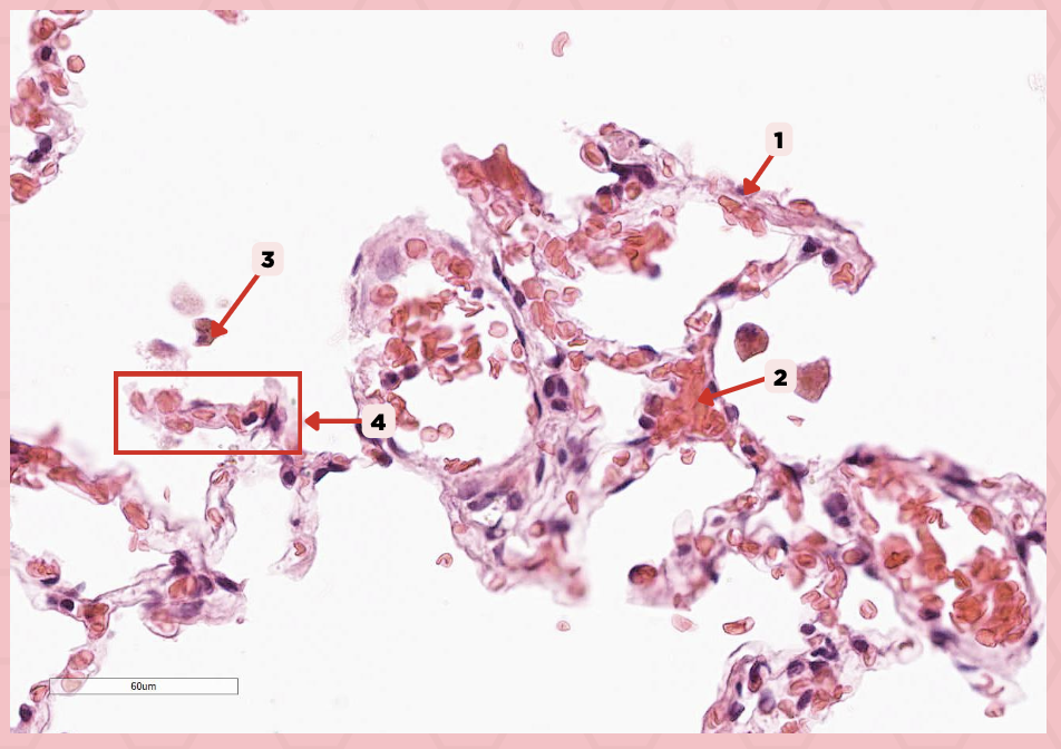 <p>Which of the following labeled structures covers 95% of the alveolar surface?</p>