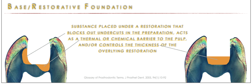 <ul><li><p>Substance placed under a restoration that blocks out <strong>undercuts</strong> in the preparation, acts as a thermal or chemical barrier to the pulp, and/or controls the thickness of the overlying restoration.</p></li></ul><p></p>