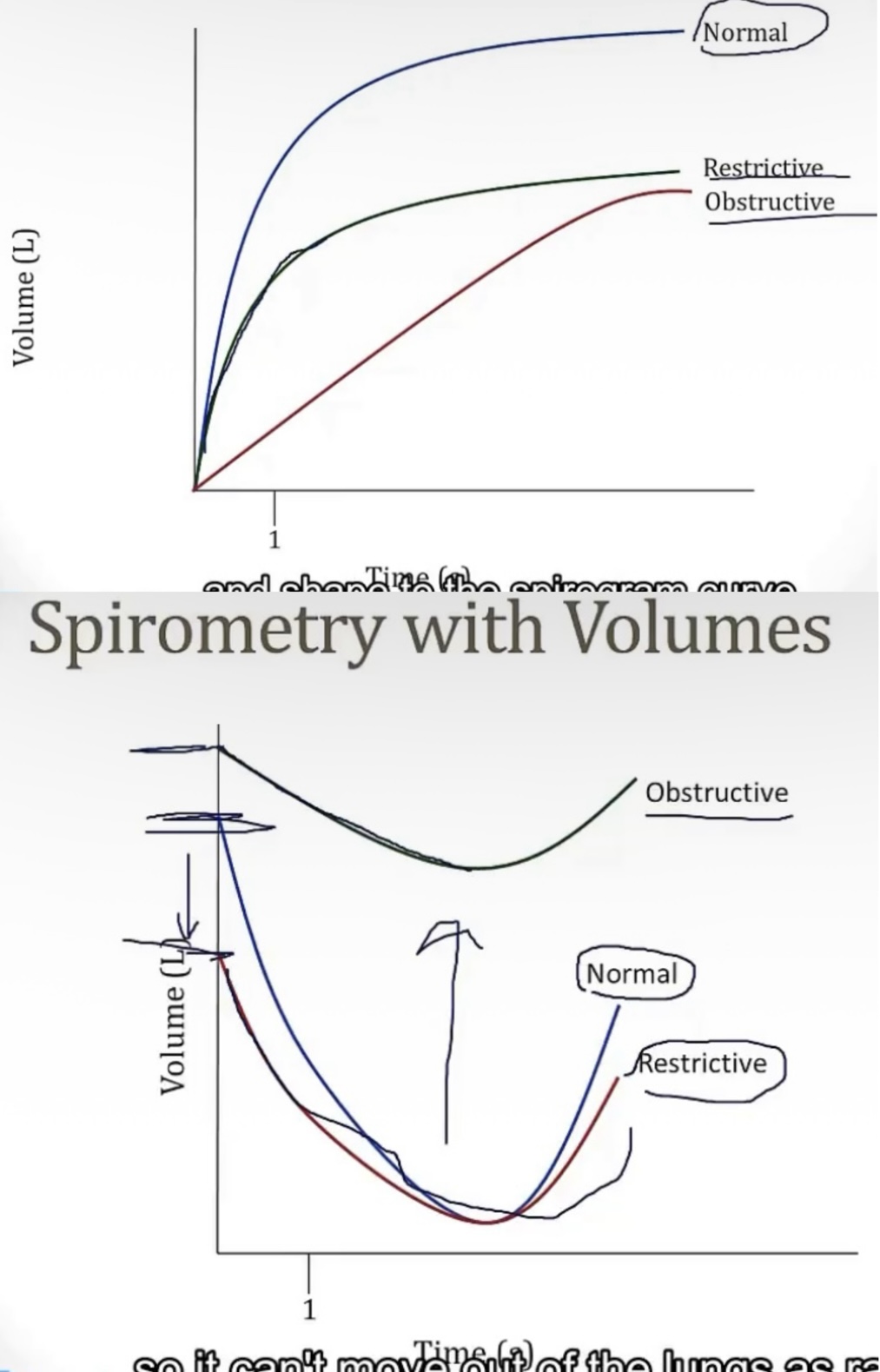 <p>-pulmonary function</p><p>-volume; time</p><p>-sharp peak; 6 seconds</p><p>-residual volume; forced residual capacity</p><p></p><p>SPIROMETRY WITH VOLUMES…</p><p>-residual volume; upside down</p><p>-greater; lesser</p>