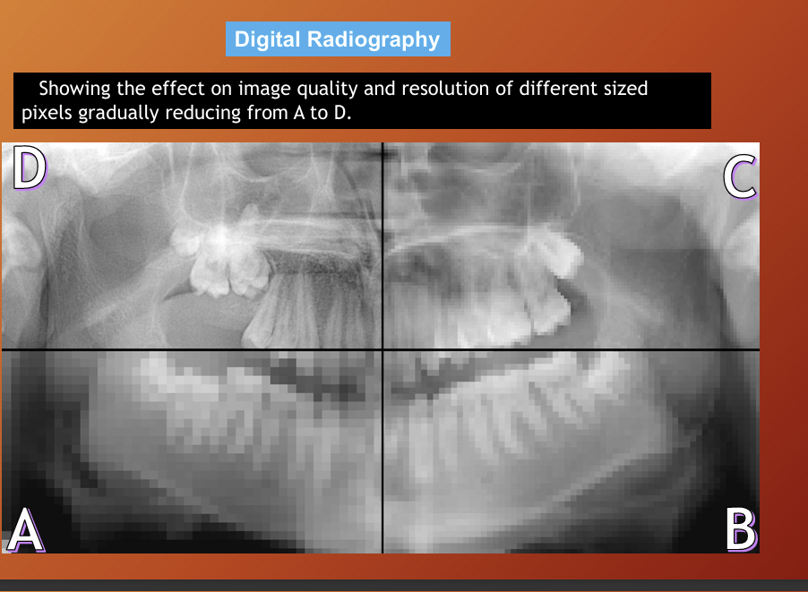 <p>resolution of digital radiography</p>