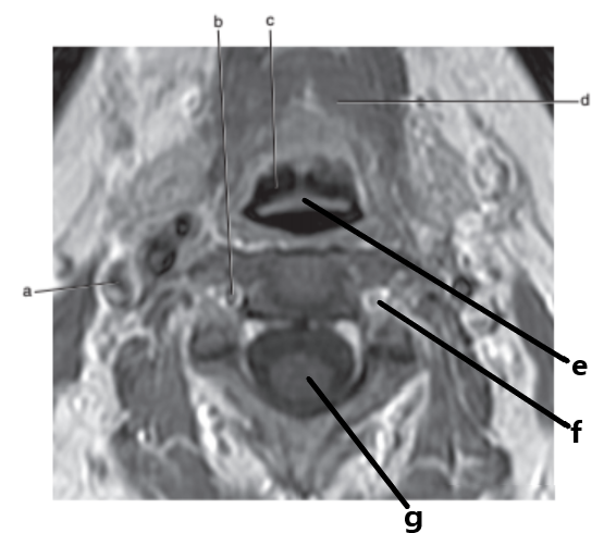 <p>What is letter e ?</p>