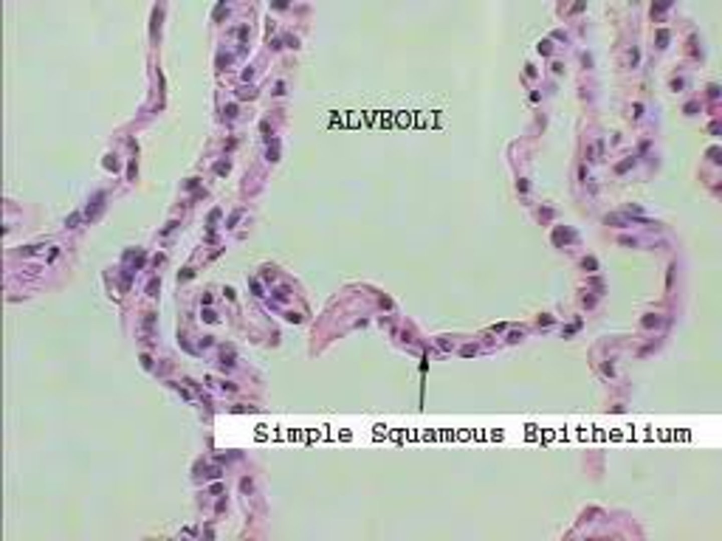 <p>Alveoli, endothelium, kidney corpuscle</p>