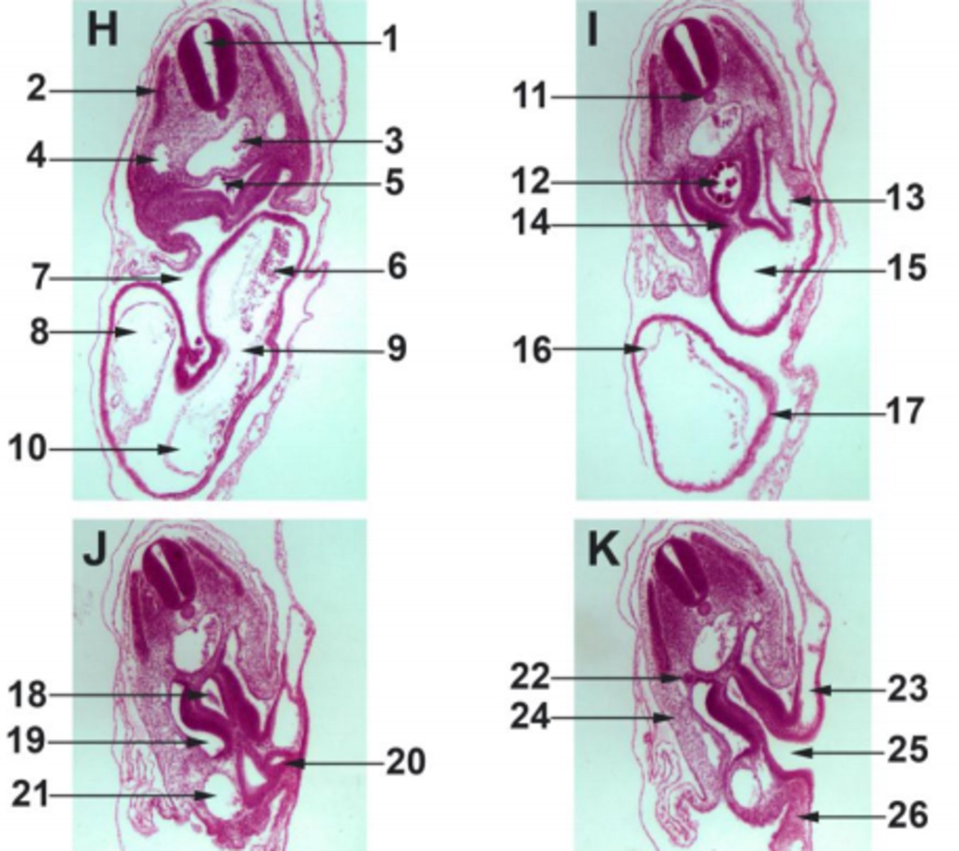 <p>#12 endoderm</p>