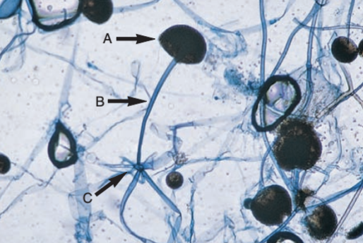 <p>Rhizopus</p>