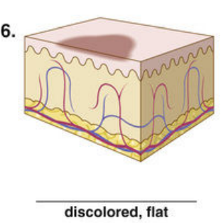 <p><span style="color: red">F Match each of the following lesions with their illustrations in Figure 16-26.</span></p><p></p>