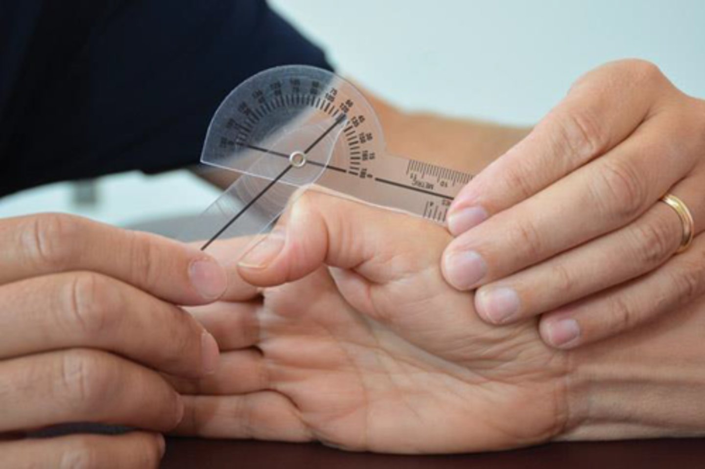 <p>fulcrum: dorsal surface of IP joint<br>proximal: dorsal midline of proximal phalanx<br>distal: dorsal midline of distal phalanx<br><br>supinated</p>