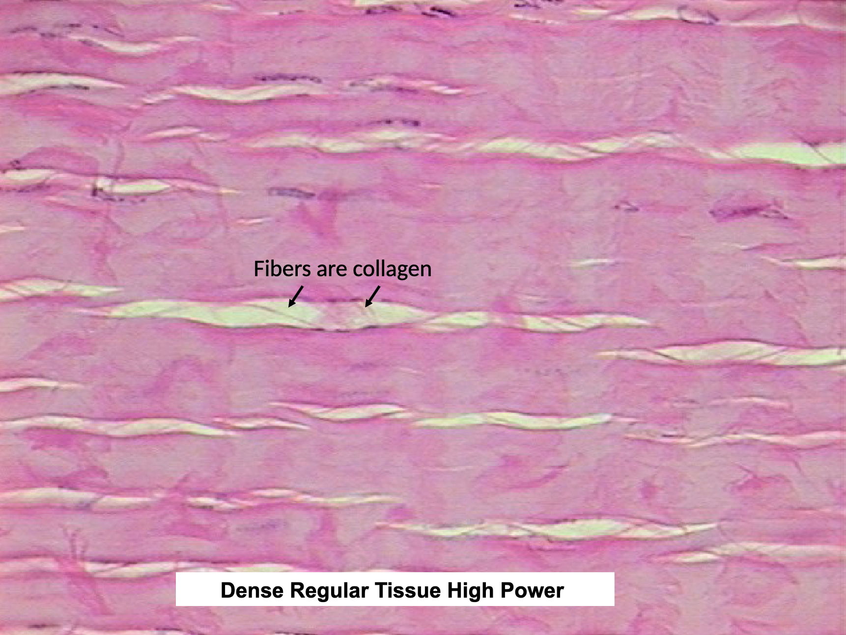 <ul><li><p>tendons, ligaments, aponeuroses</p></li><li><p>strength in one direction </p></li><li><p>*LOOK FOR FIBERS</p></li></ul><p></p>