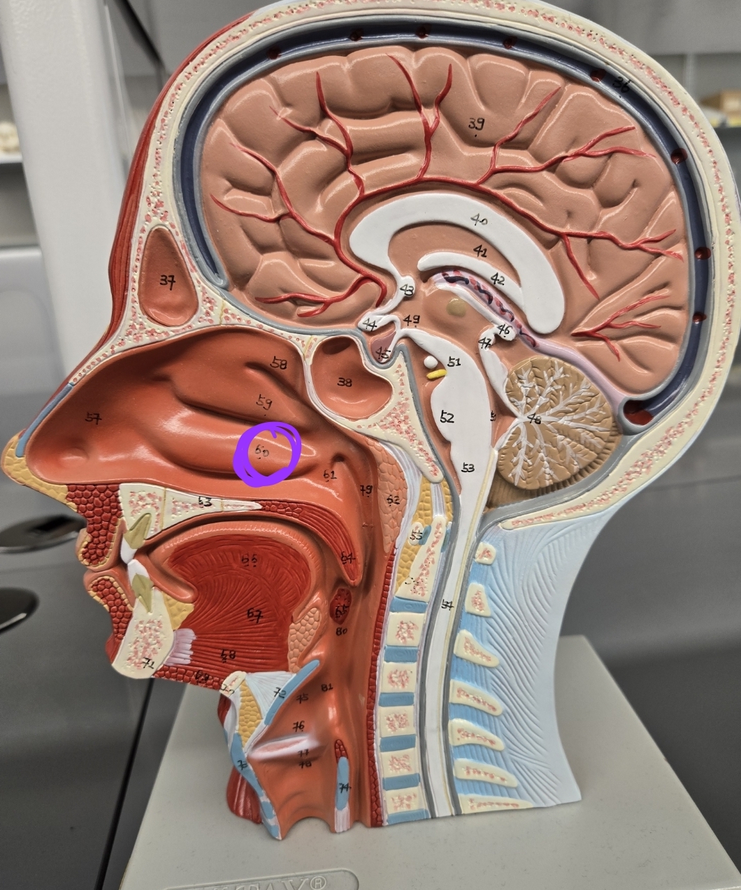 <p>Half head model: what structure is this?</p>