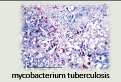 <p>Acid fast bacteria </p>