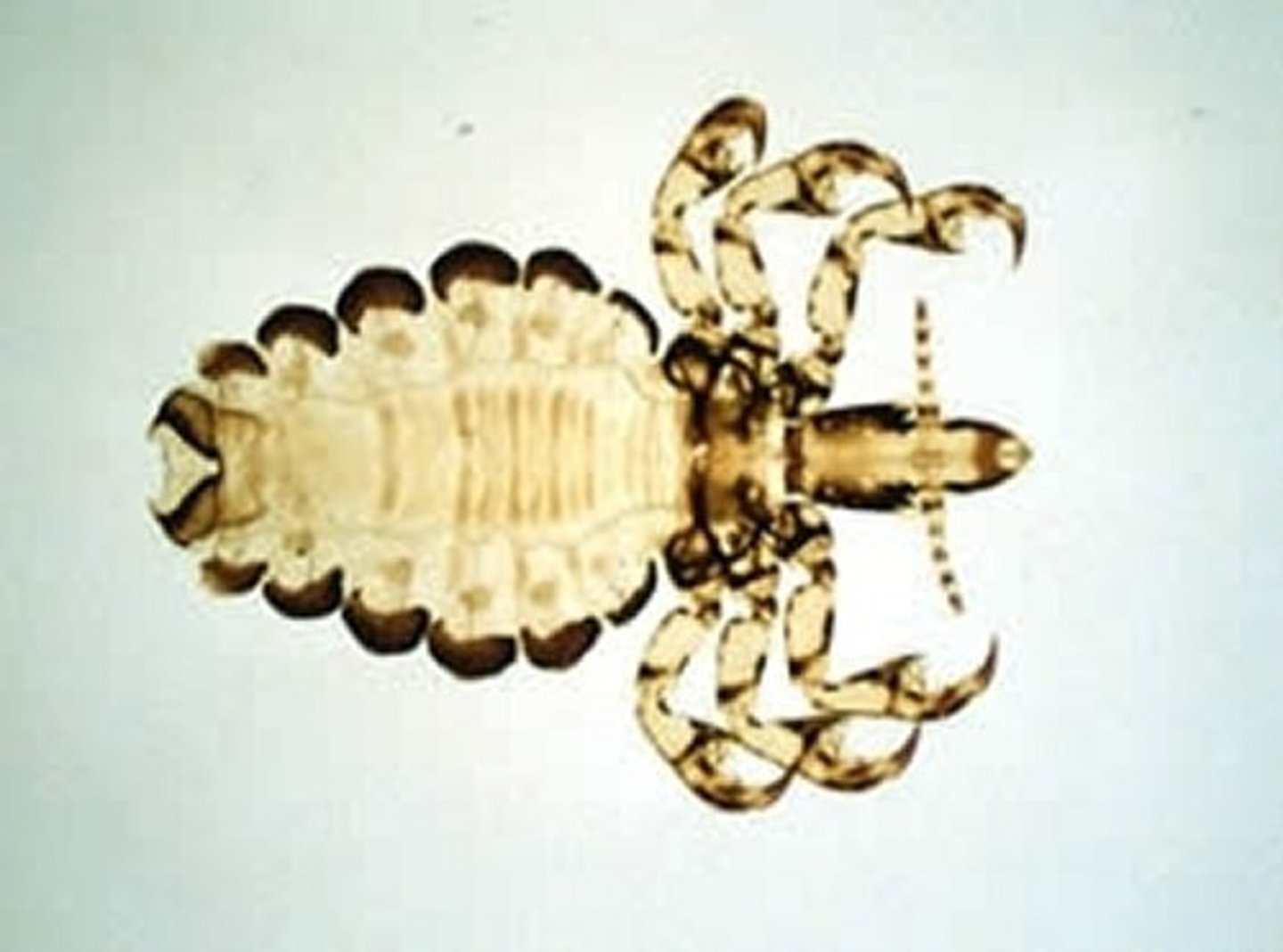 <p><span>This was found on an anemic pig.&nbsp; What is it?</span></p>