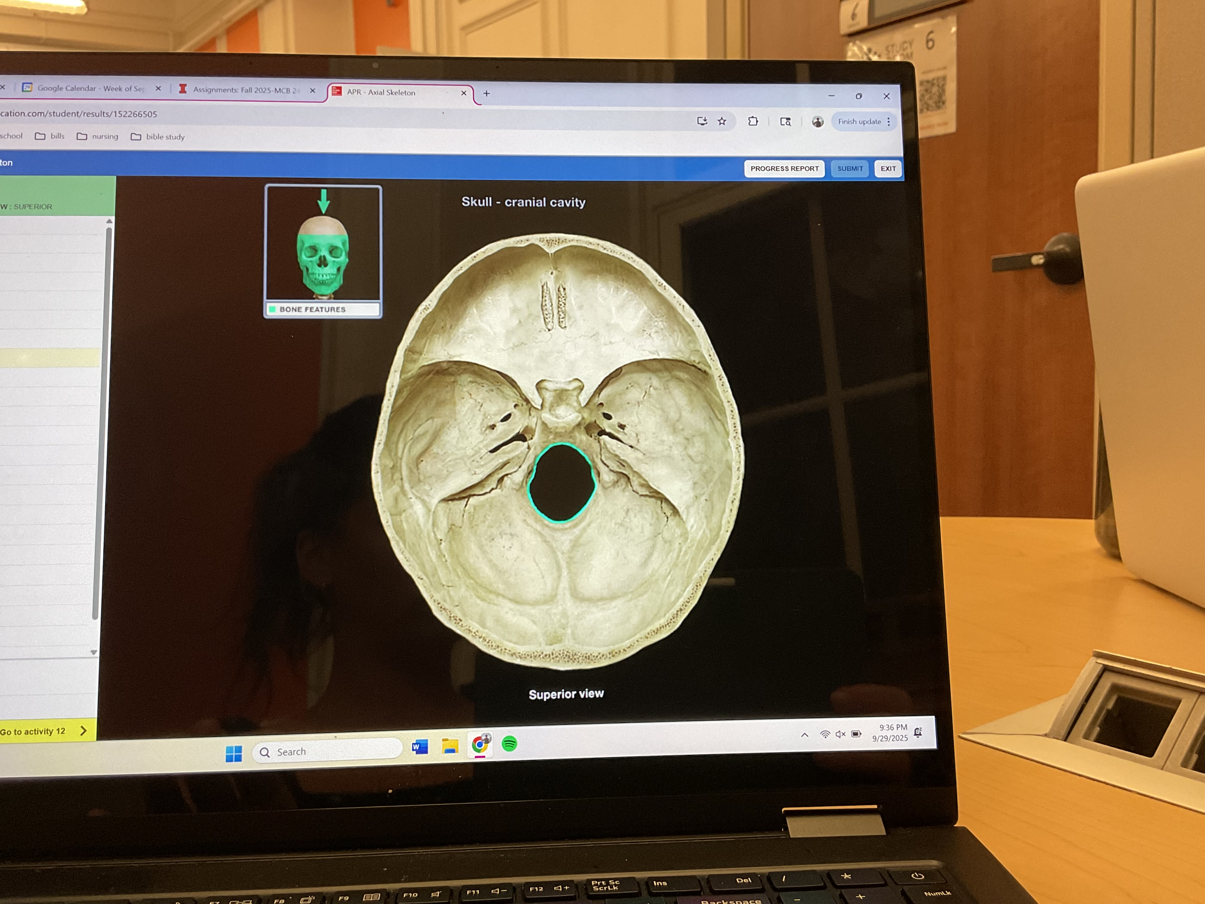 <p>Foramen magnum</p>