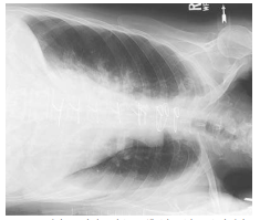 <p>What projection/position is this?</p>