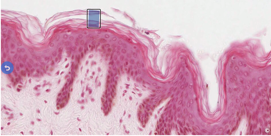 <p>identify the surface specialization</p>