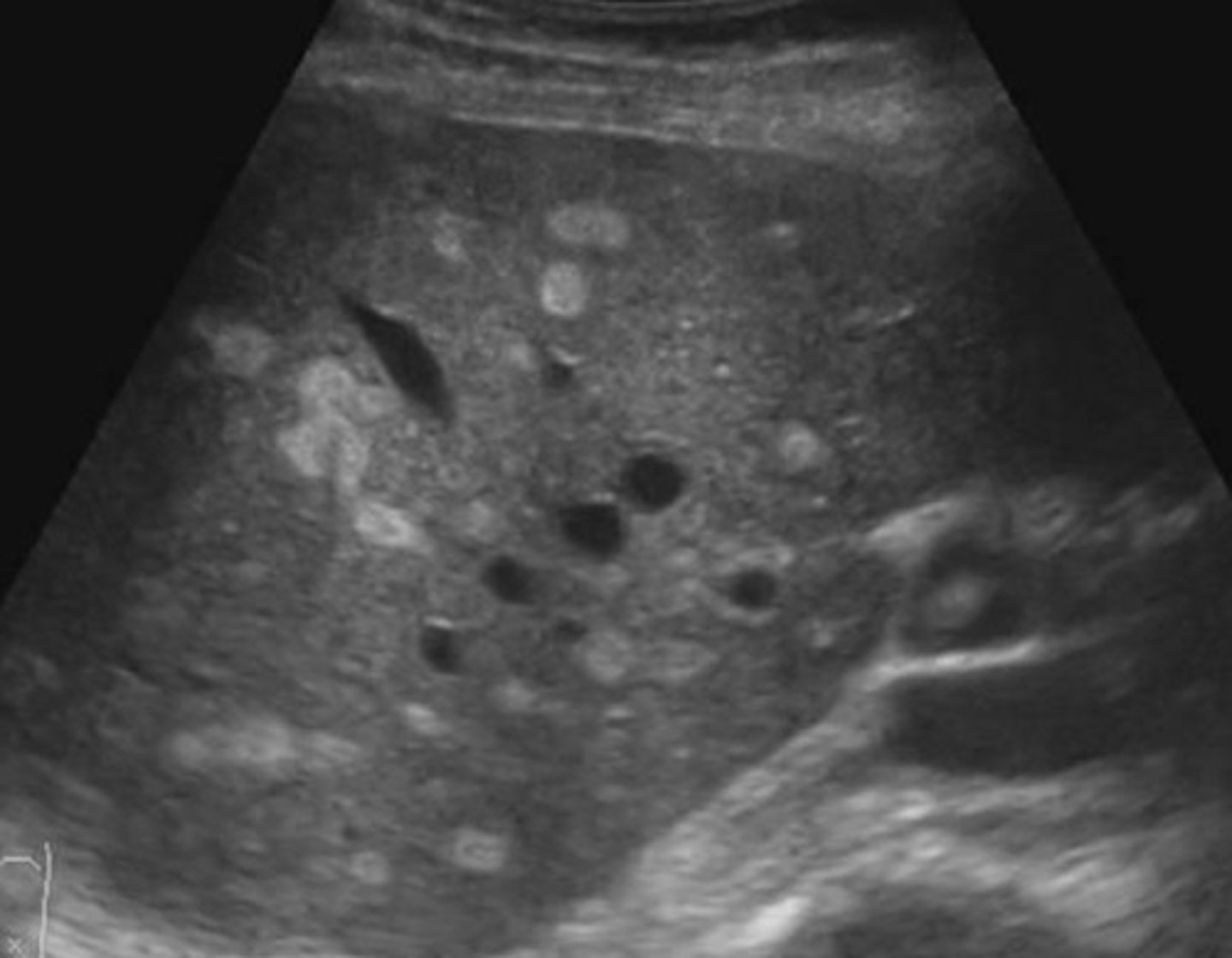 <p>What is going on here? Is this normal or abnormal?</p>