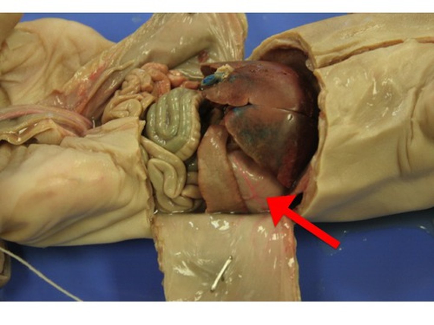 <p>A muscular and elastic sac that serves mainly to store food, break it up mechanically, and begin chemical digestion of proteins and fat.</p>