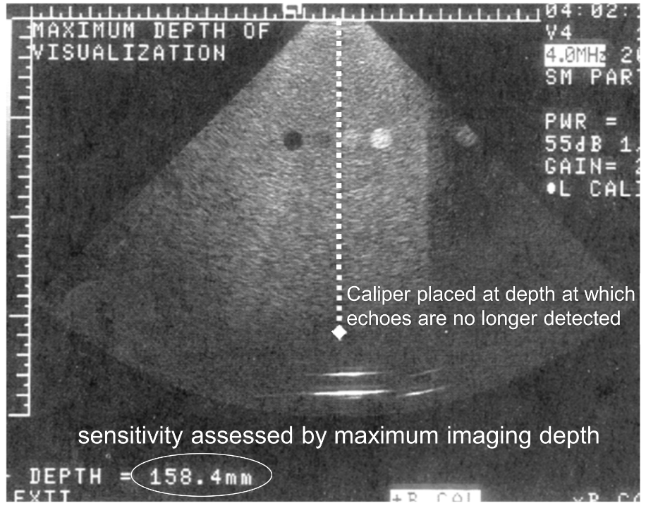 <p>By using a TE phantom, ensuring the power, gain, and focus optimized for penetration. Measure the max depth of visualization at which the echoes are no longer available. Record these results.</p>