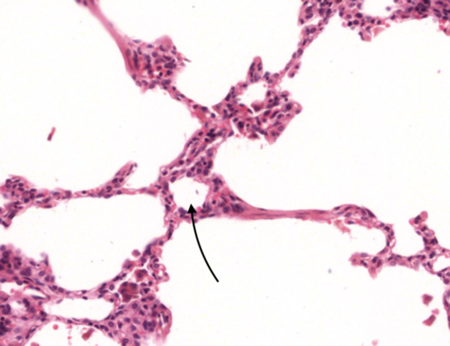 <p>air sac in the lung</p>